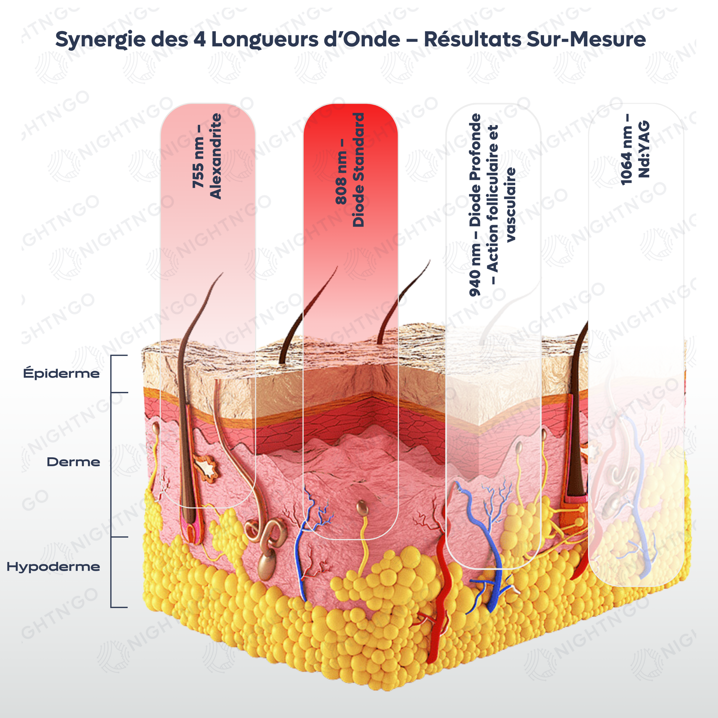 Technologie de refroidissement par saphir sur appareil d'épilation laser professionnel, protection de la peau et traitement indolore. 4 longueur d'ondes laser diodes