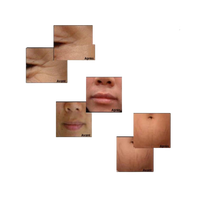 Masque de carboxythérapie, masque carboxy, masque carboxy CO2, Masque CO2,
Soin visage innovant
Oxygénation cellulaire
Microcirculation
Peaux acnéiques
Réduction des boutons
Pores resserrés
Teint uniforme
Régénération cutanée
Taches pigmentaires
Effet Bohr
Peau éclatante
Anti-âge
Hydratation profonde
Soin dermo-cosmétique
Masque de Carboxythérapie CO₂, soin visage innovant. Stimule l’oxygénation cellulaire, améliore la microcirculation et réduit les imperfections cutanées. Idéal pour réduire les boutons