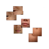 Masque de carboxythérapie, masque carboxy, masque carboxy CO2, Masque CO2,
Soin visage innovant
Oxygénation cellulaire
Microcirculation
Peaux acnéiques
Réduction des boutons
Pores resserrés
Teint uniforme
Régénération cutanée
Taches pigmentaires
Effet Bohr
Peau éclatante
Anti-âge
Hydratation profonde
Soin dermo-cosmétique
Masque de Carboxythérapie CO₂, soin visage innovant. Stimule l’oxygénation cellulaire, améliore la microcirculation et réduit les imperfections cutanées. Idéal pour réduire les boutons