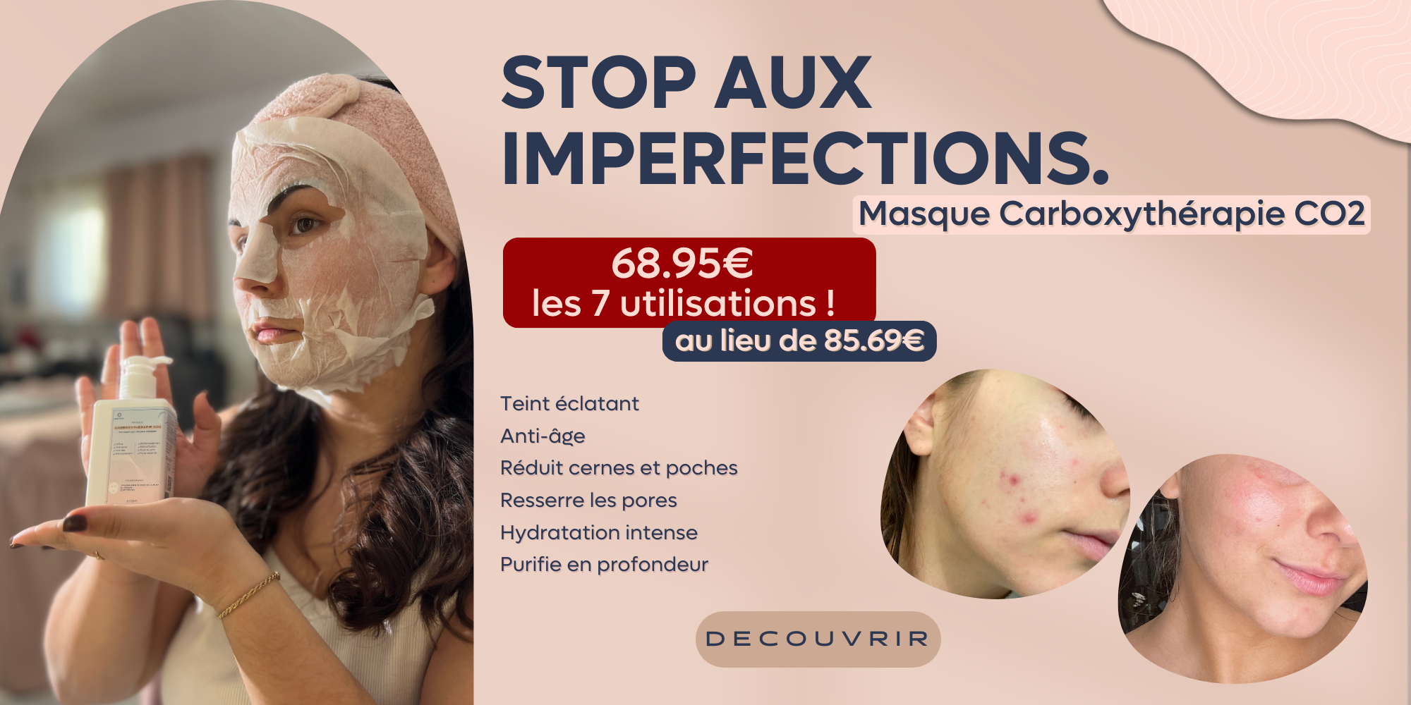 Carboxytherapie, carboxy CO2, masque carboxy, carbo C02, carboxytherapy