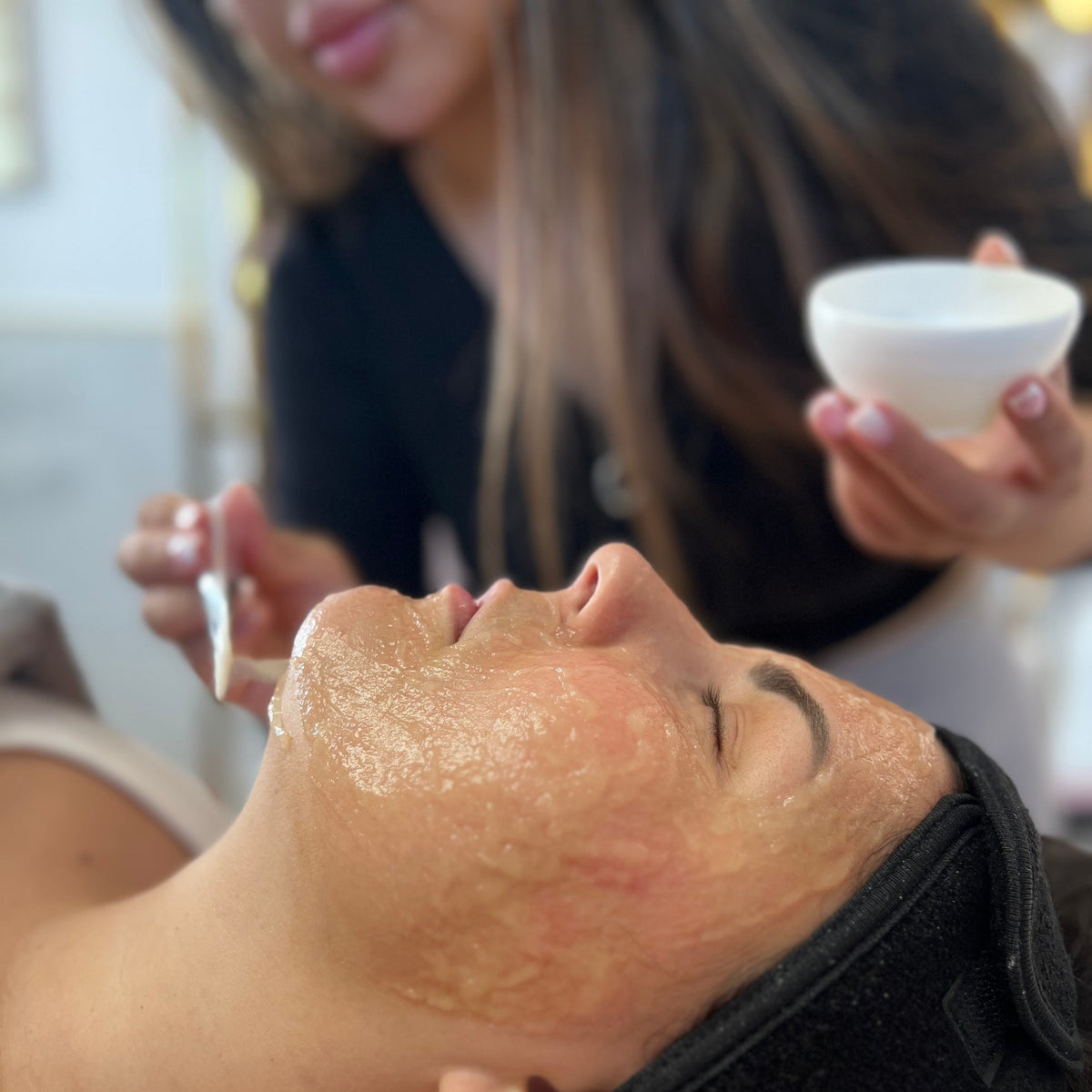 Application du gel de carboxythérapie CO₂ sur le visage, étape du protocole professionnel