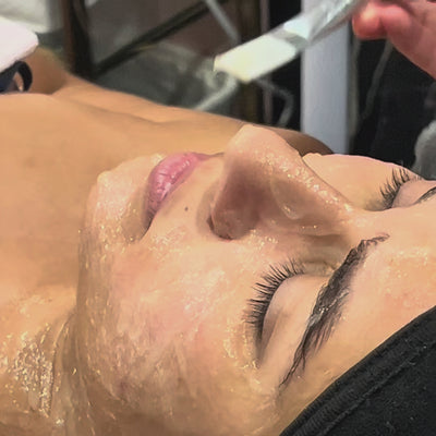 Vidéo application du masque de carboxytherapie