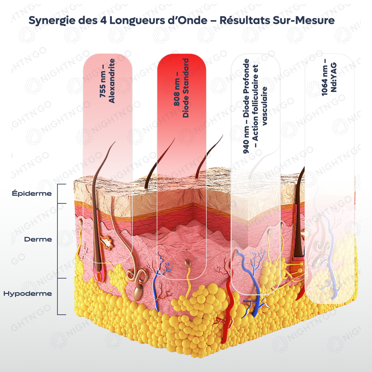 Machine épilation laser diode. Sonde laser avec réglages directs et affichage intégré, technologie quadri-onde 755 nm, 808 nm, 940 nm et 1064 nm. synergie des 4 longueurs d'ondes 