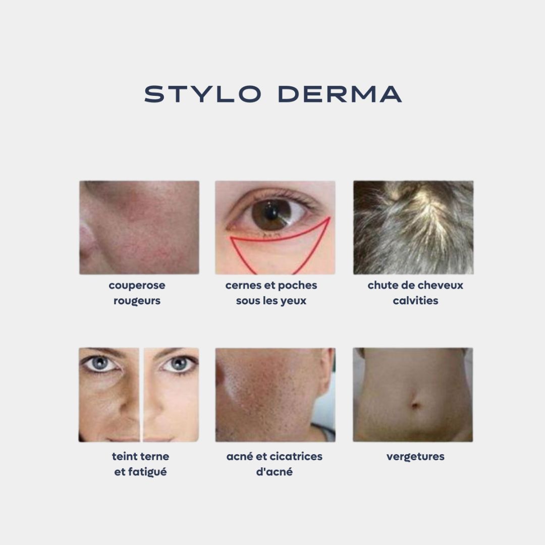 Dermapen microneedling, derma pen led, microneedle, mésothérapie, stylo derma, bbglow
